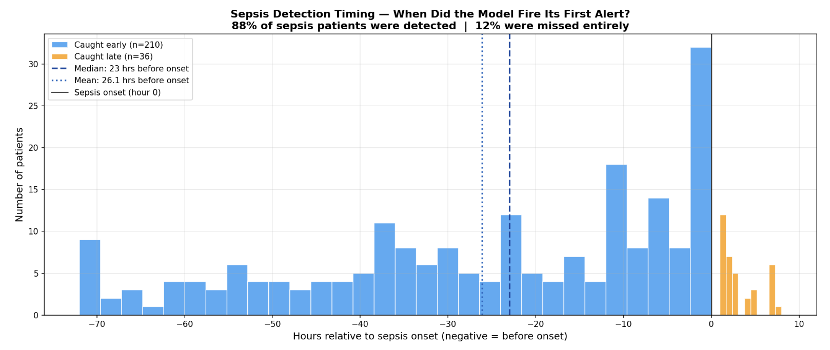 Early Sepsis Detection Using Machine Learning